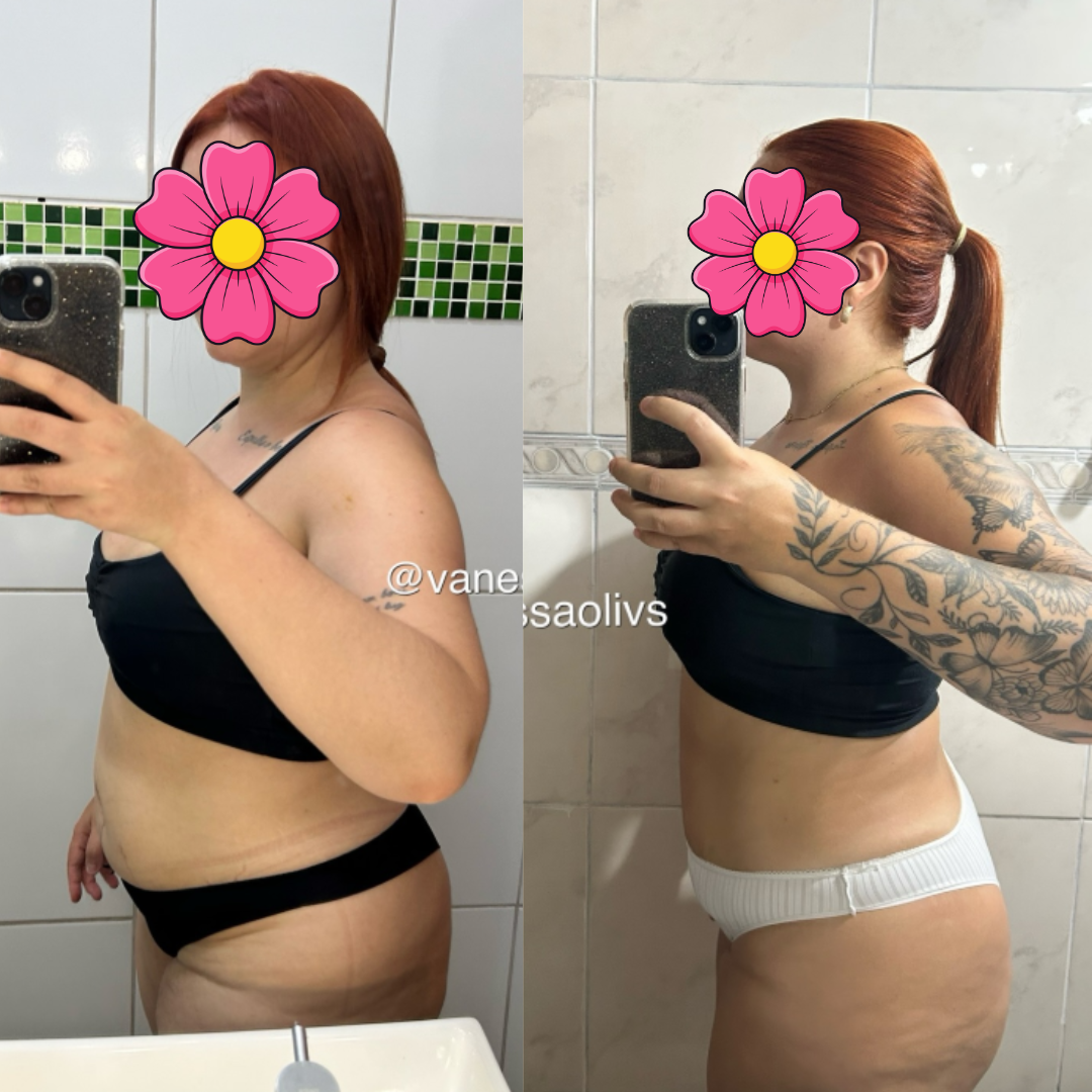 Resultado real